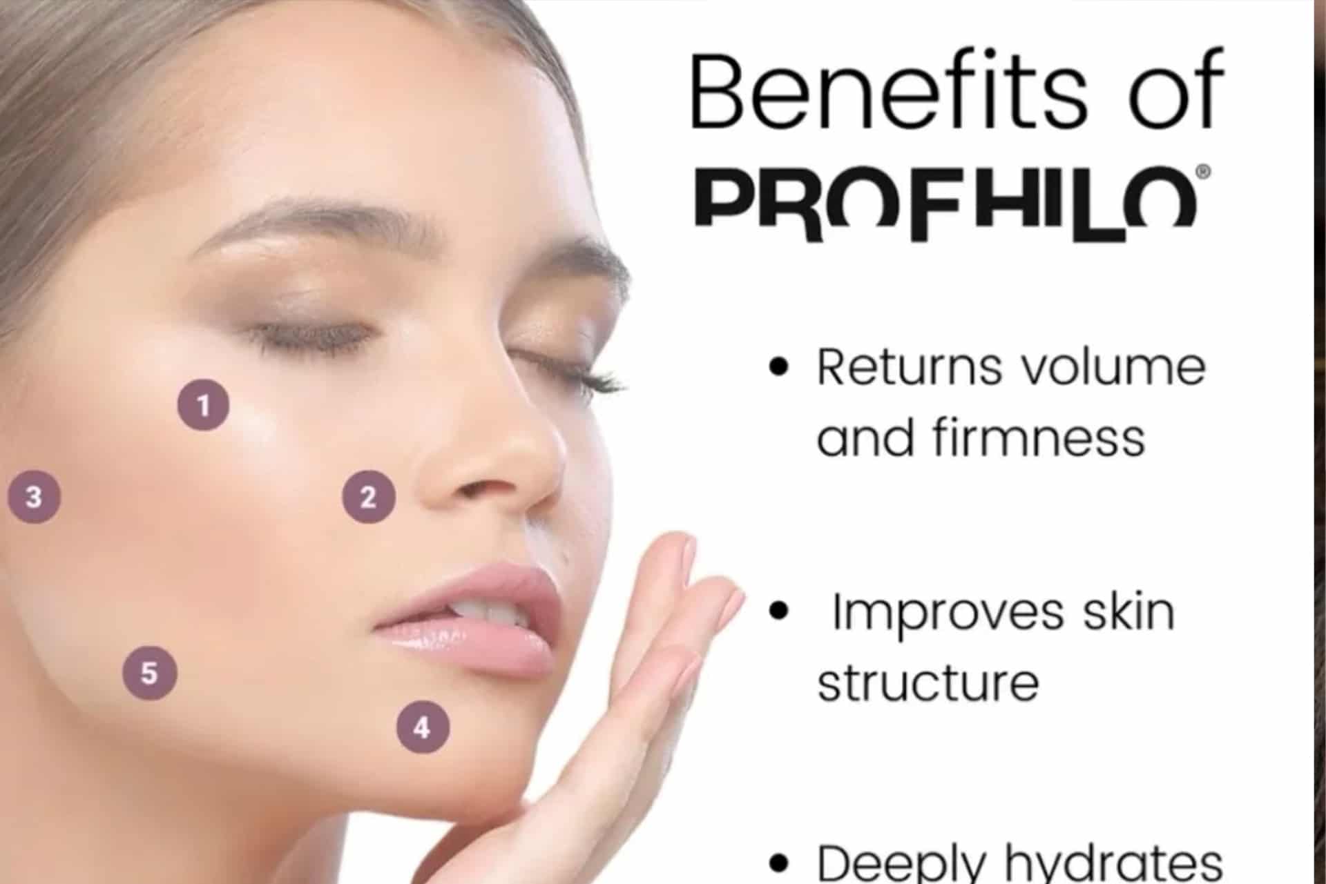 benefits of profhilo