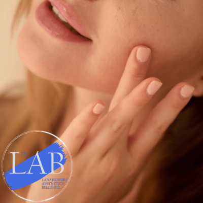 fine line microneedling